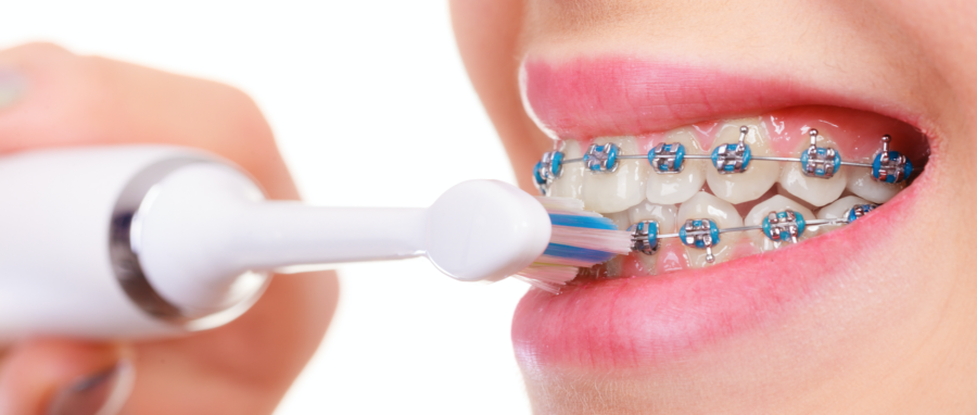 brushing teeth with braces