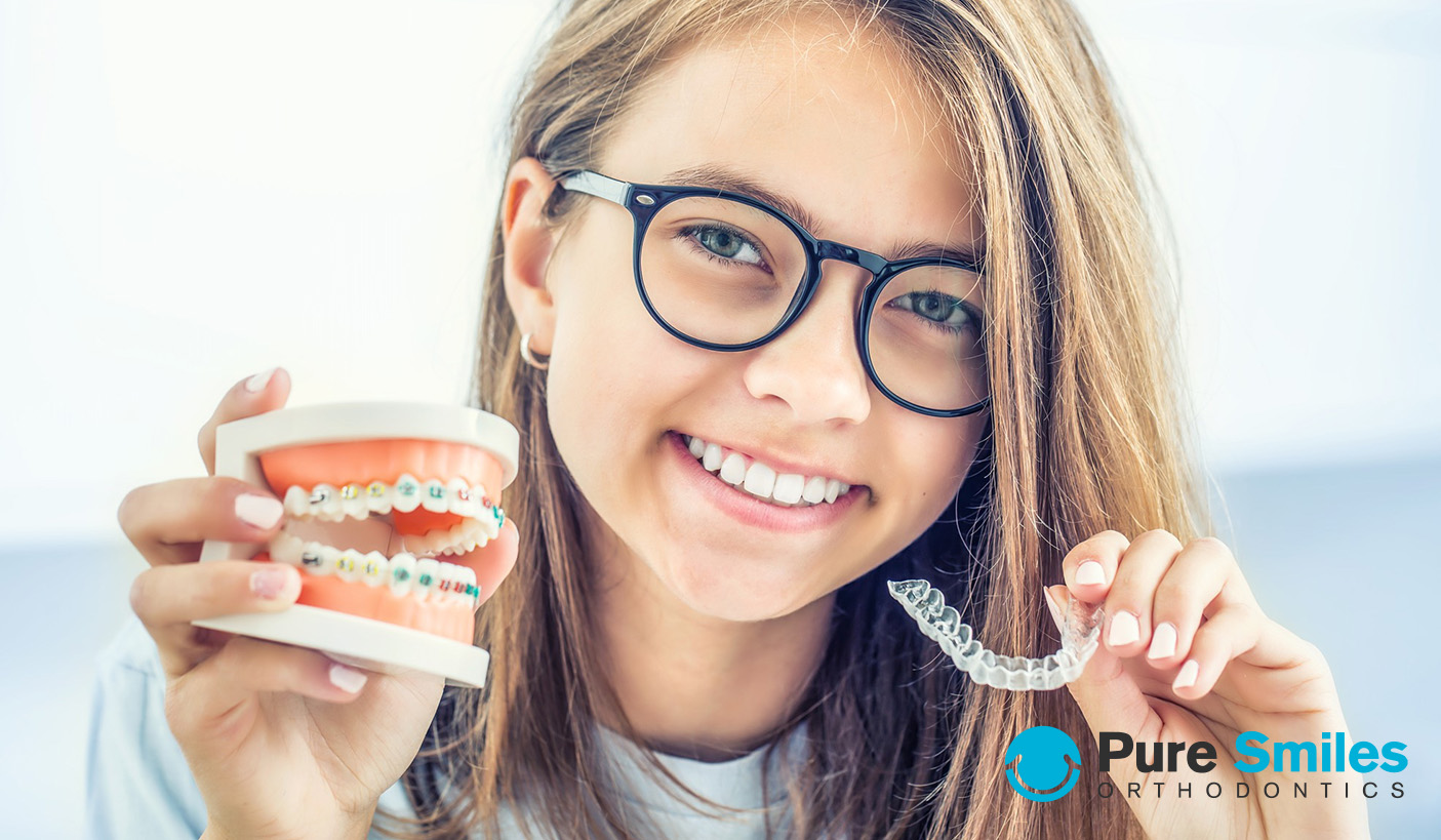 braces vs. aligners