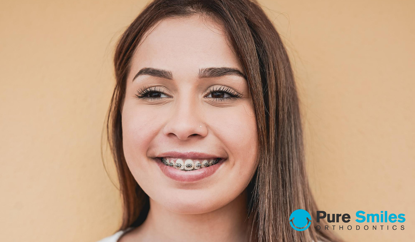 how long will I be in braces?